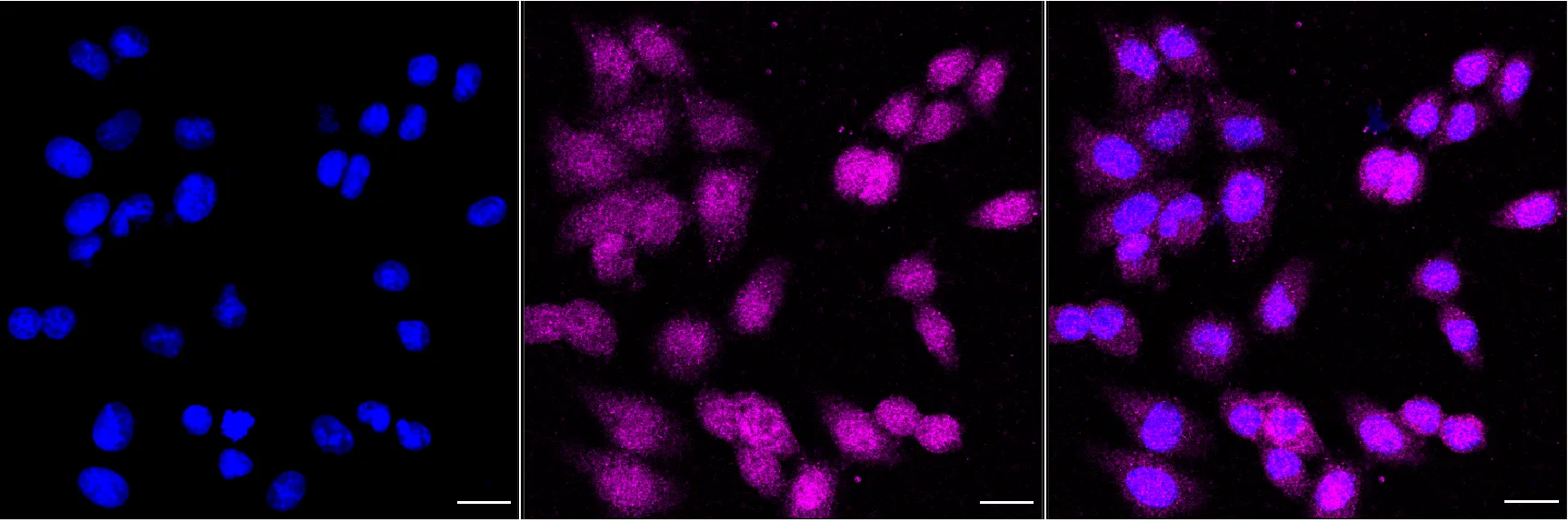 Immunocytochemistry(ICC) - KD-Validated Checkpoint Kinase 1 Recombinant Rabbit Monoclonal Antibody KVAb01442