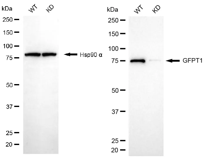 KD-Validated GFPT1 Recombinant Rabbit Monoclonal Antibody