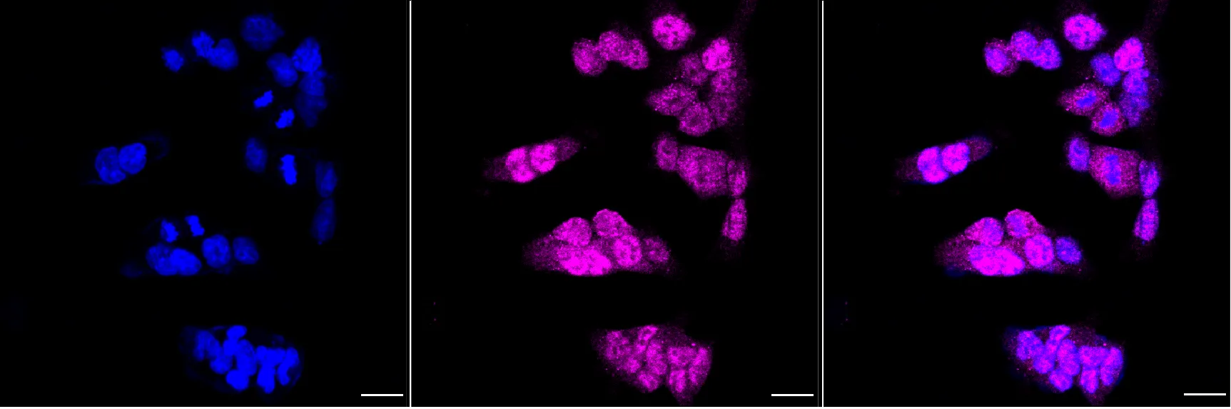 Immunocytochemistry(ICC) - KD-Validated MYC Mouse Monoclonal Antibody KVAb01452