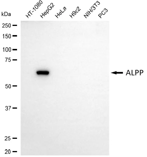WesternBlot(WB) - KD-Validated ALPP Mouse Monoclonal Antibody KVAb01456