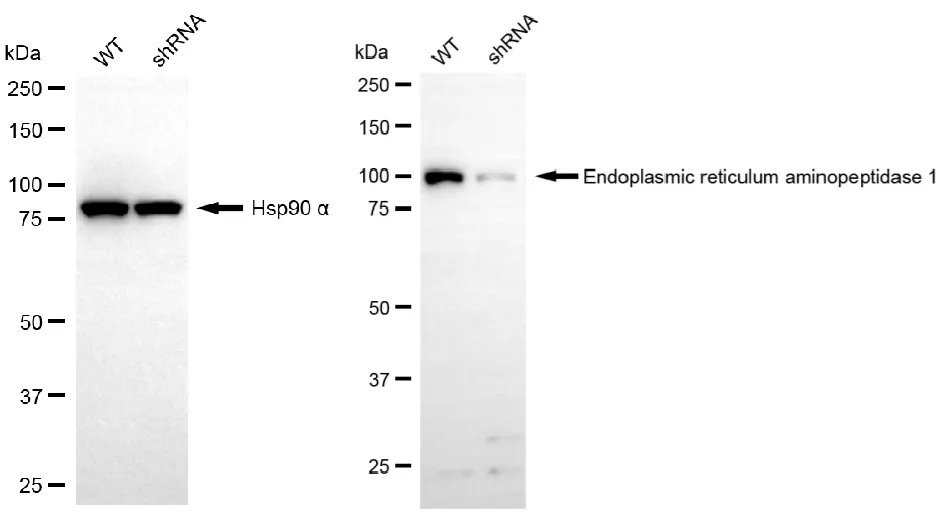 KD-Validated Endoplasmic Reticulum Aminopeptidase 1 Recombinant Rabbit Monoclonal Antibody