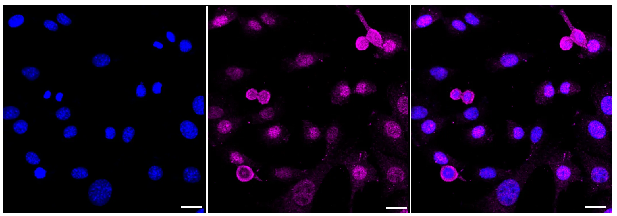 Immunocytochemistry(ICC) - KD-Validated Syntaxin Binding Protein 1 Recombinant Rabbit Monoclonal Antibody KVAb01475