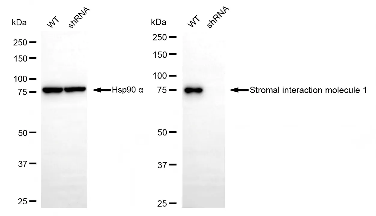 KD-Validated Stromal Interaction Molecule 1 Recombinant Rabbit Monoclonal Antibody