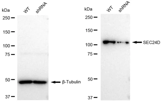 KD-Validated SEC24D Recombinant Rabbit Monoclonal Antibody