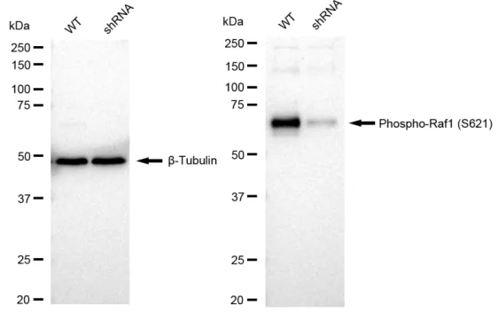 KD-Validated Phospho-Raf1 (S621) Recombinant Rabbit Monoclonal Antibody