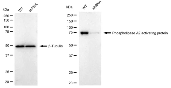 KD-Validated Phospholipase A2 Activating Protein Recombinant Rabbit Monoclonal Antibody