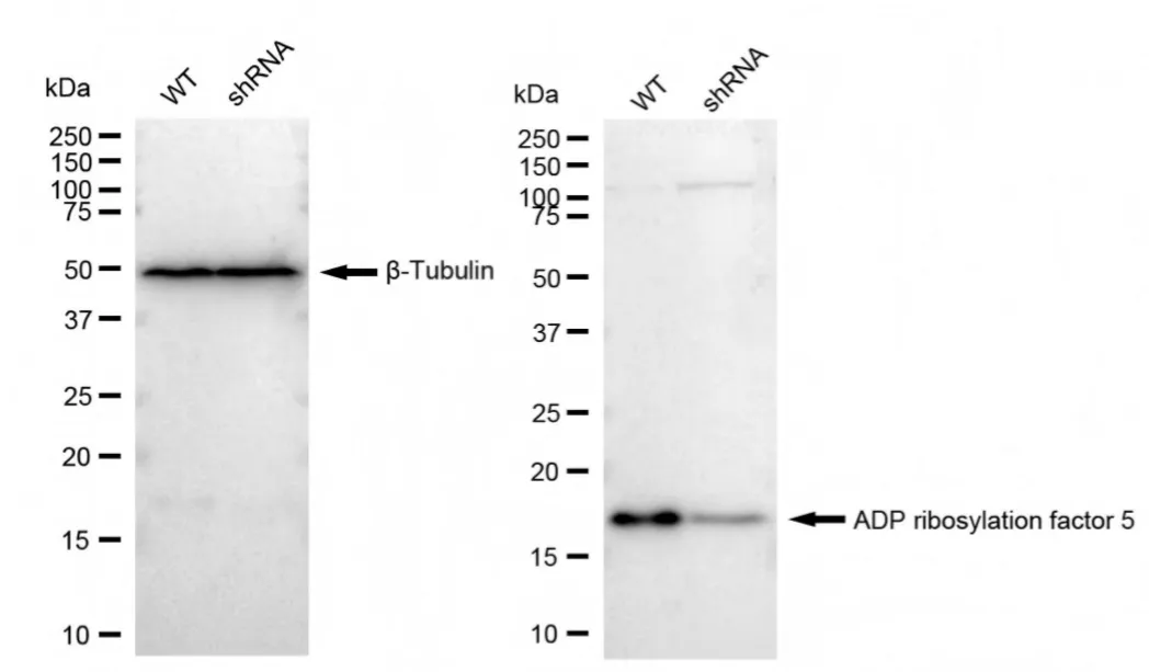 KD-Validated ADP Ribosylation Factor 5 Recombinant Rabbit Monoclonal Antibody