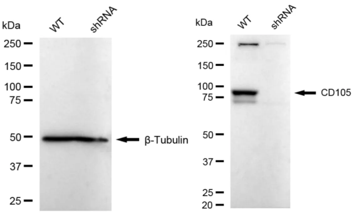 KD-Validated CD105 Recombinant Rabbit Monoclonal Antibody