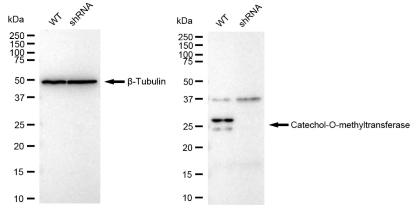 KD-Validated Catechol-O-Methyltransferase Recombinant Rabbit Monoclonal Antibody