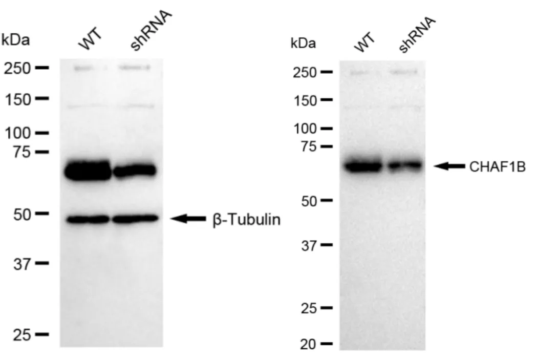 KD-Validated CHAF1B Recombinant Rabbit Monoclonal Antibody