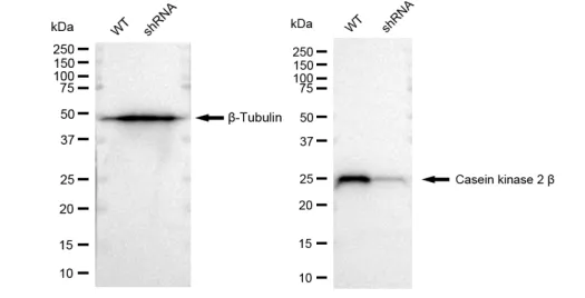 KD-Validated Casein Kinase 2 Beta Recombinant Rabbit Monoclonal Antibody