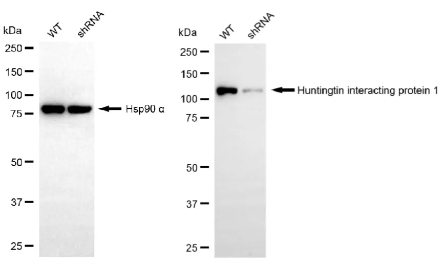 KD-Validated Huntingtin Interacting Protein 1 Recombinant Rabbit Monoclonal Antibody