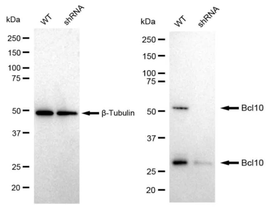 KD-Validated Bcl10 Recombinant Rabbit Monoclonal Antibody