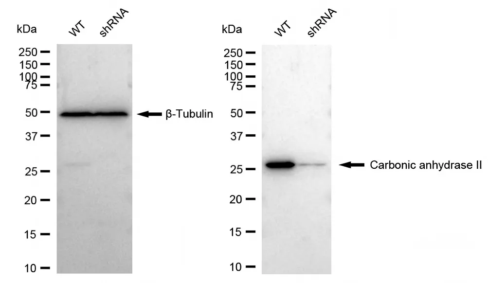 KD-Validated Carbonic Anhydrase II Recombinant Rabbit Monoclonal Antibody