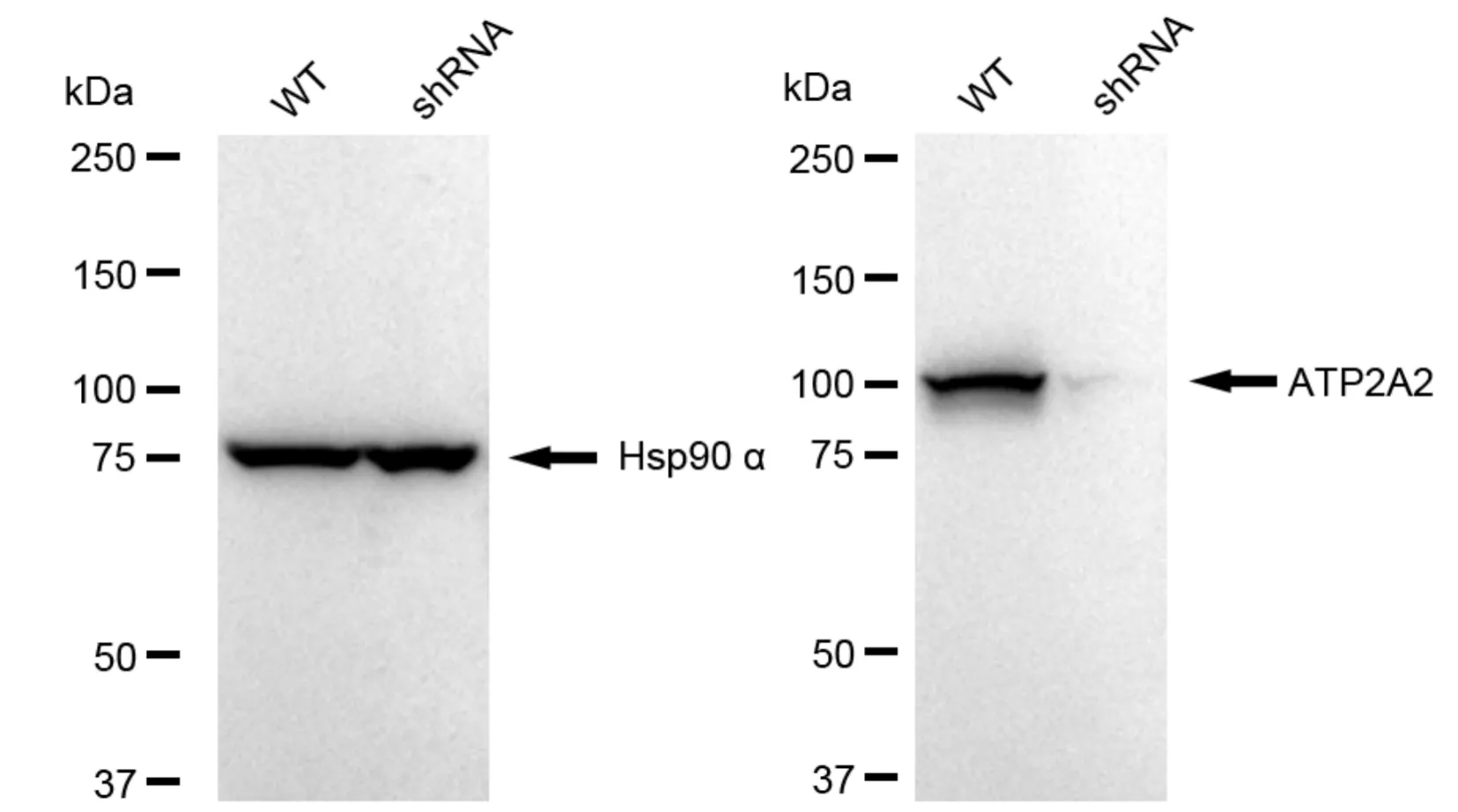 KD-Validated ATP2A2 Recombinant Rabbit Monoclonal Antibody