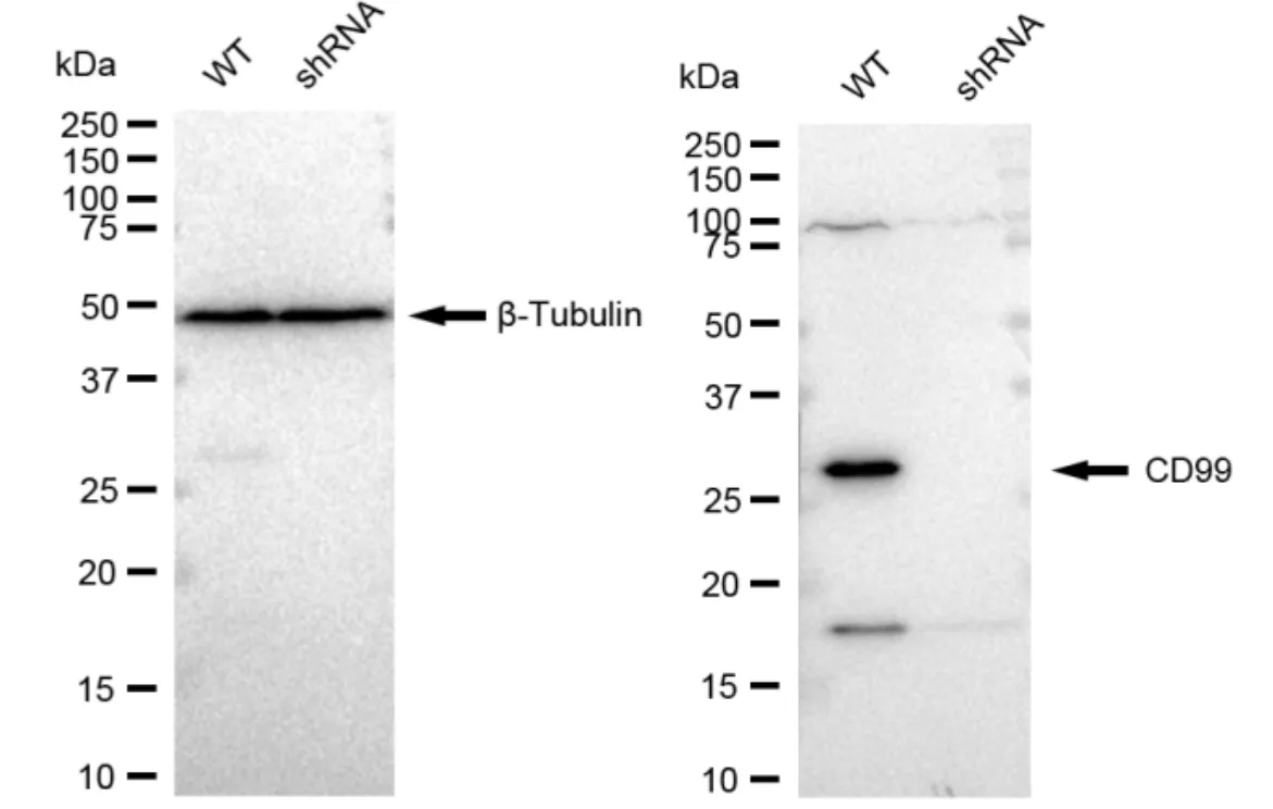 KD-Validated CD99 Recombinant Rabbit Monoclonal Antibody