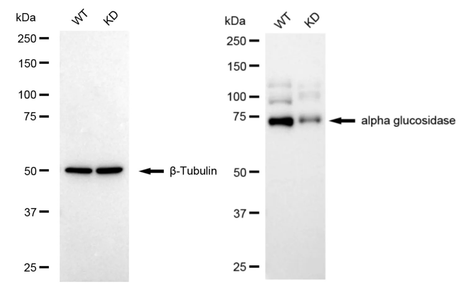KD-Validated Alpha Glucosidase Recombinant Rabbit Monoclonal Antibody