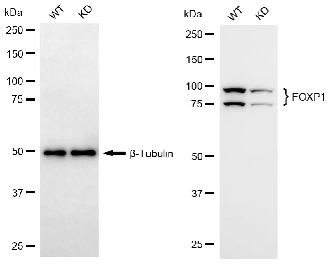 KD-Validated FOXP1 Recombinant Rabbit Monoclonal Antibody