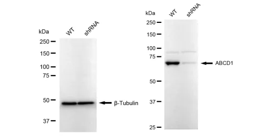 KD-Validated ABCD1 Recombinant Rabbit Monoclonal Antibody