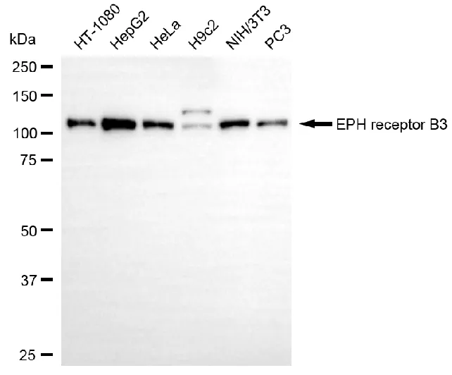 WesternBlot(WB) - KD-Validated Eph Receptor B3 Recombinant Rabbit Monoclonal Antibody KVAb01622