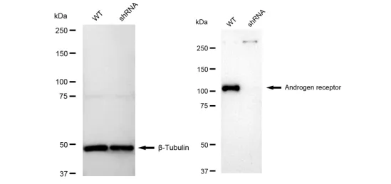 KD-Validated Androgen Receptor Recombinant Rabbit Monoclonal Antibody