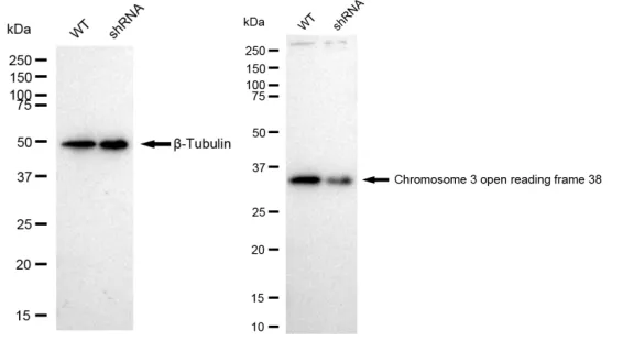 KD-Validated Chromosome 3 Open Reading Frame 38 Recombinant Rabbit Monoclonal Antibody