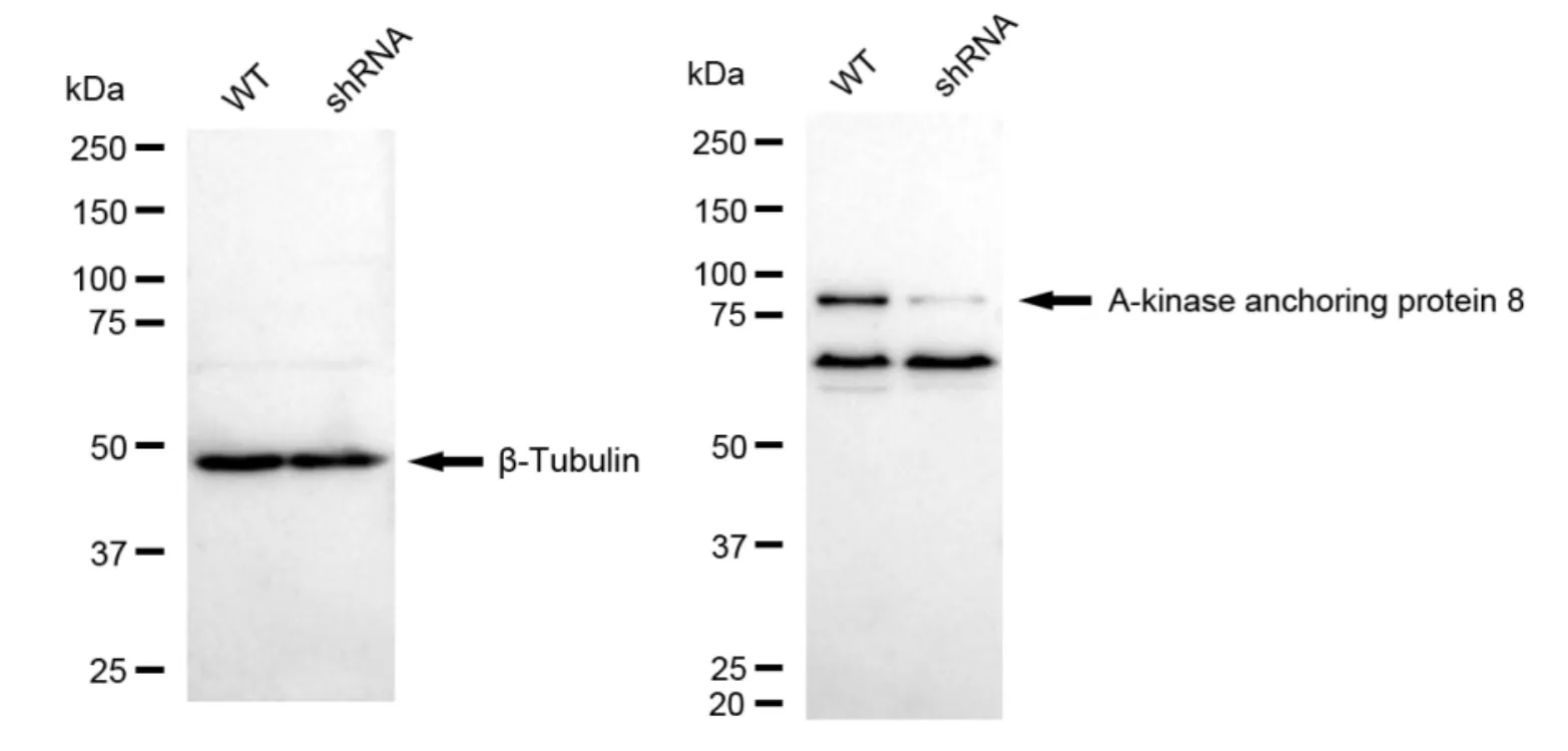 KD-Validated A-Kinase Anchoring Protein 8 Recombinant Rabbit Monoclonal Antibody