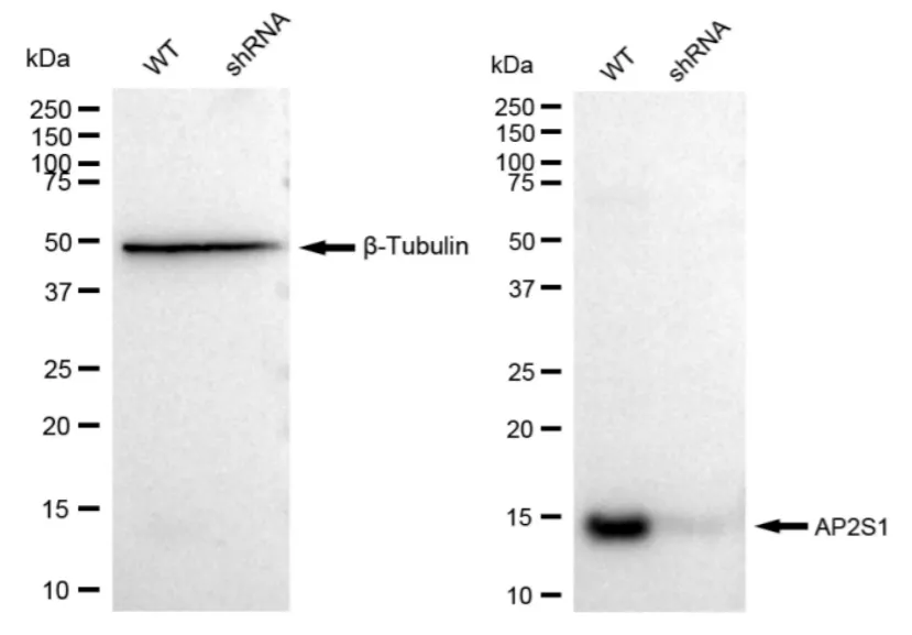 KD-Validated AP2S1 Recombinant Rabbit Monoclonal Antibody