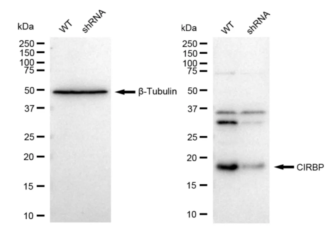 KD-Validated CIRBP Recombinant Rabbit Monoclonal Antibody