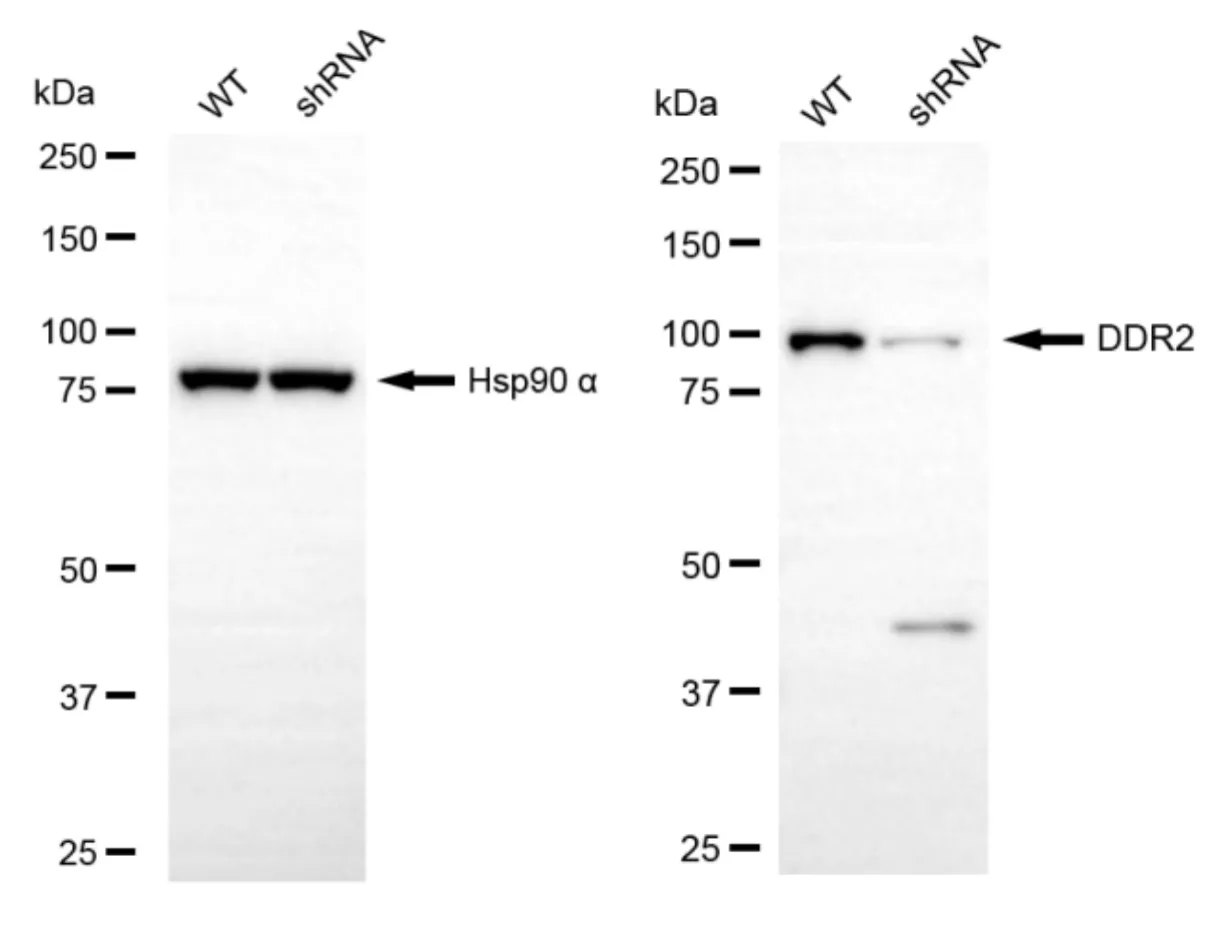 KD-Validated DDR2 Recombinant Rabbit Monoclonal Antibody