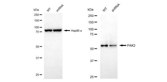 KD-Validated PAK2 Recombinant Rabbit Monoclonal Antibody