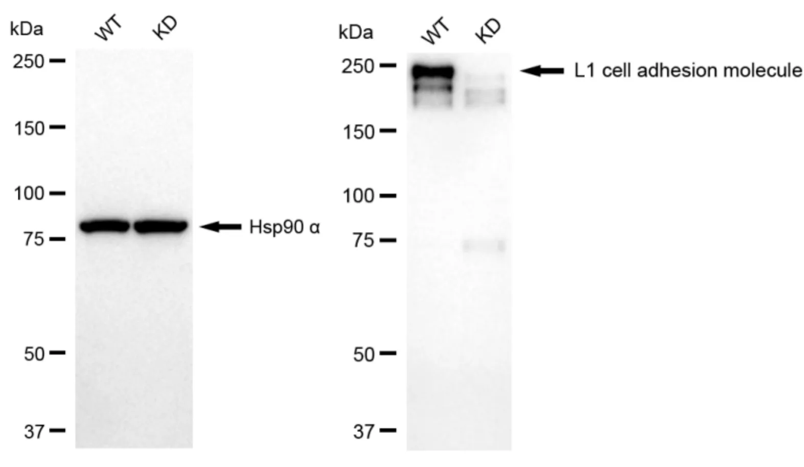 KD-Validated L1 Cell Adhesion Molecule Recombinant Rabbit Monoclonal Antibody