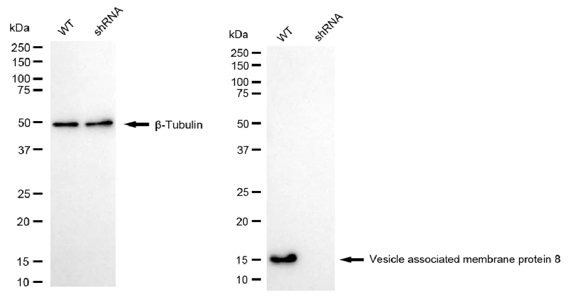 KD-Validated VAMP8 Recombinant Rabbit Monoclonal Antibody