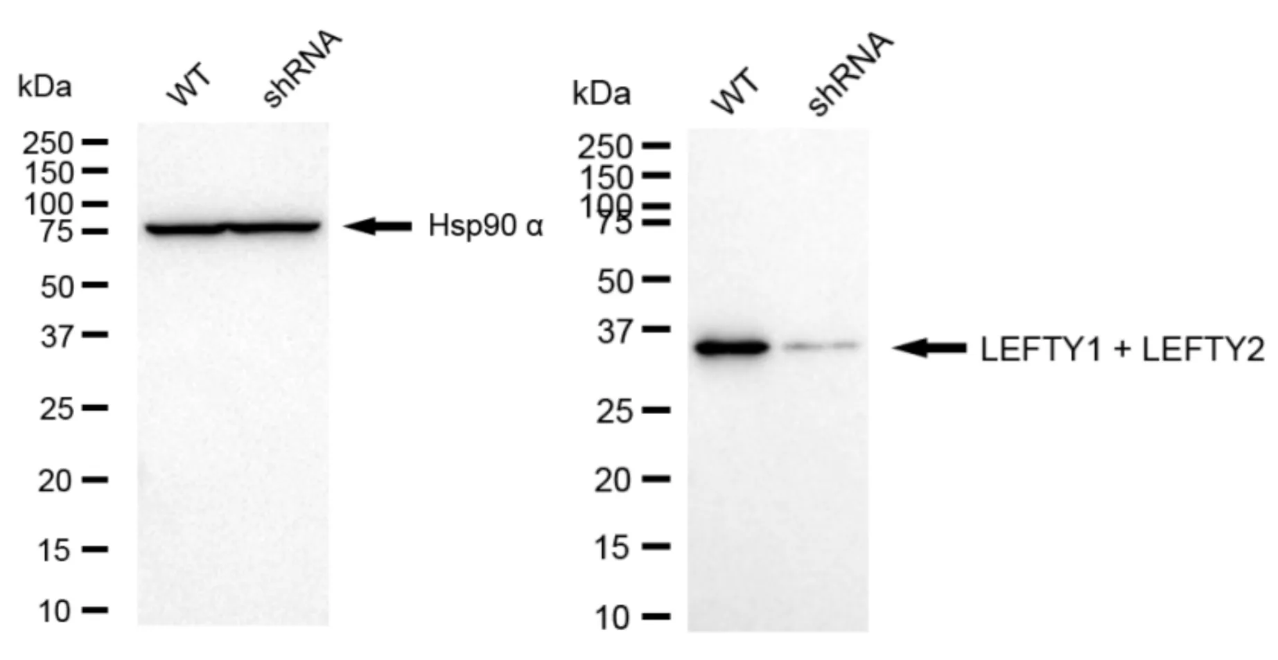 KD-Validated LEFTY1 + LEFTY2 Recombinant Rabbit Monoclonal Antibody