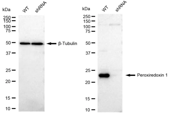 KD-Validated Peroxiredoxin 1 Recombinant Rabbit Monoclonal Antibody