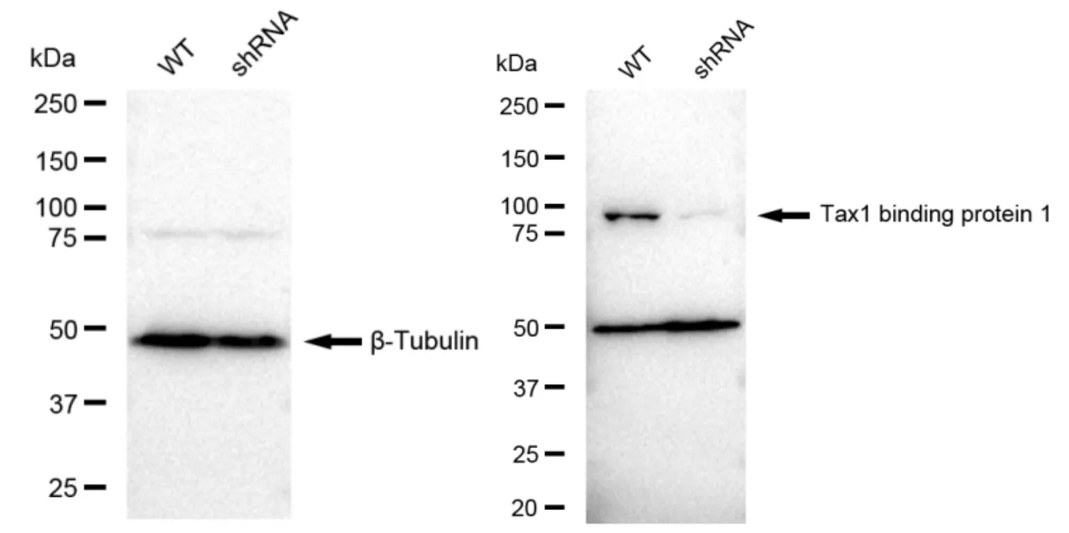 KD-Validated Tax1 Binding Protein 1 Recombinant Rabbit Monoclonal Antibody