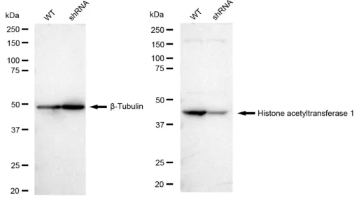 KD-Validated Histone Acetyltransferase 1 Recombinant Rabbit Monoclonal Antibody