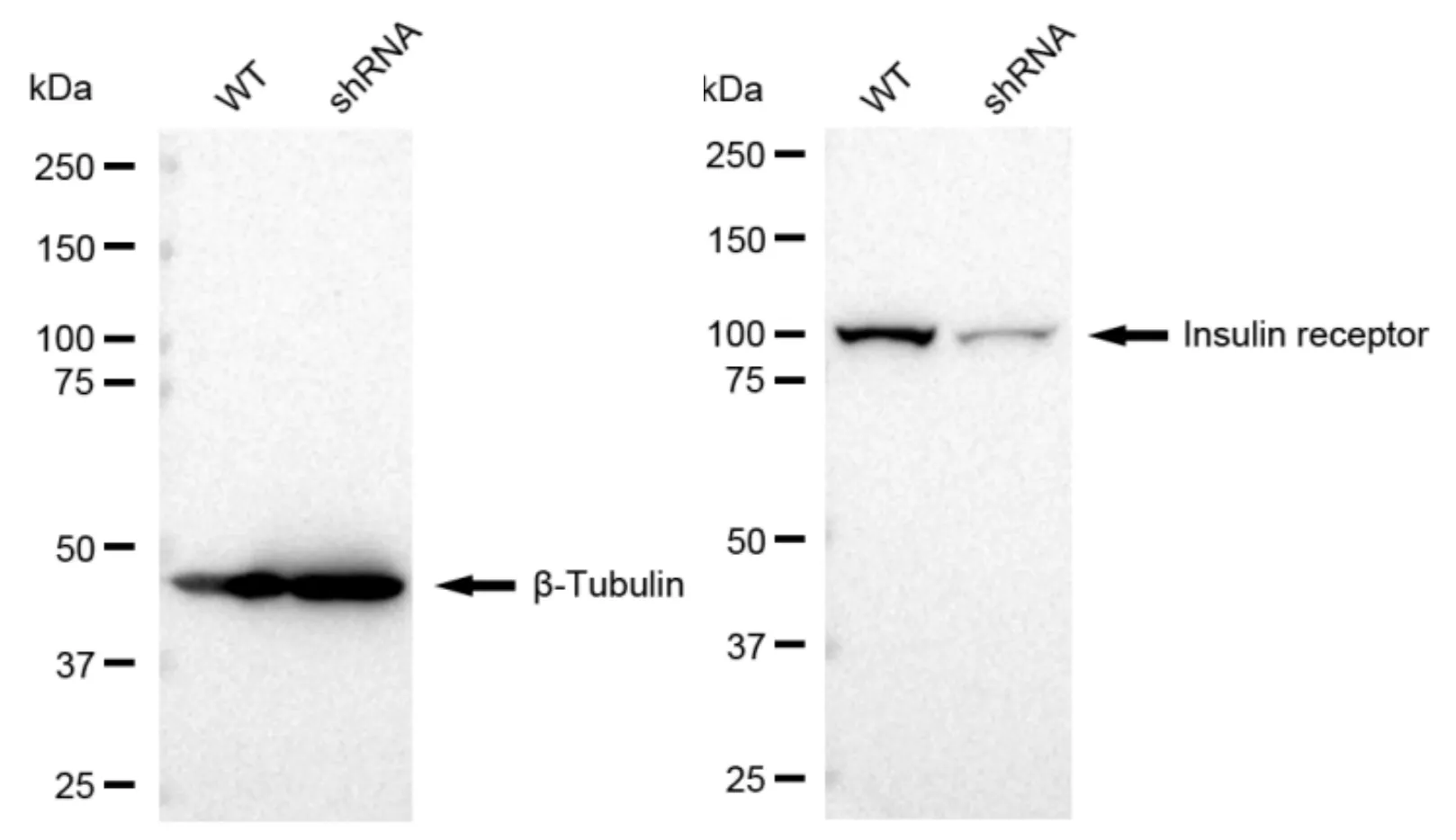 KD-Validated Insulin Receptor Recombinant Rabbit Monoclonal Antibody