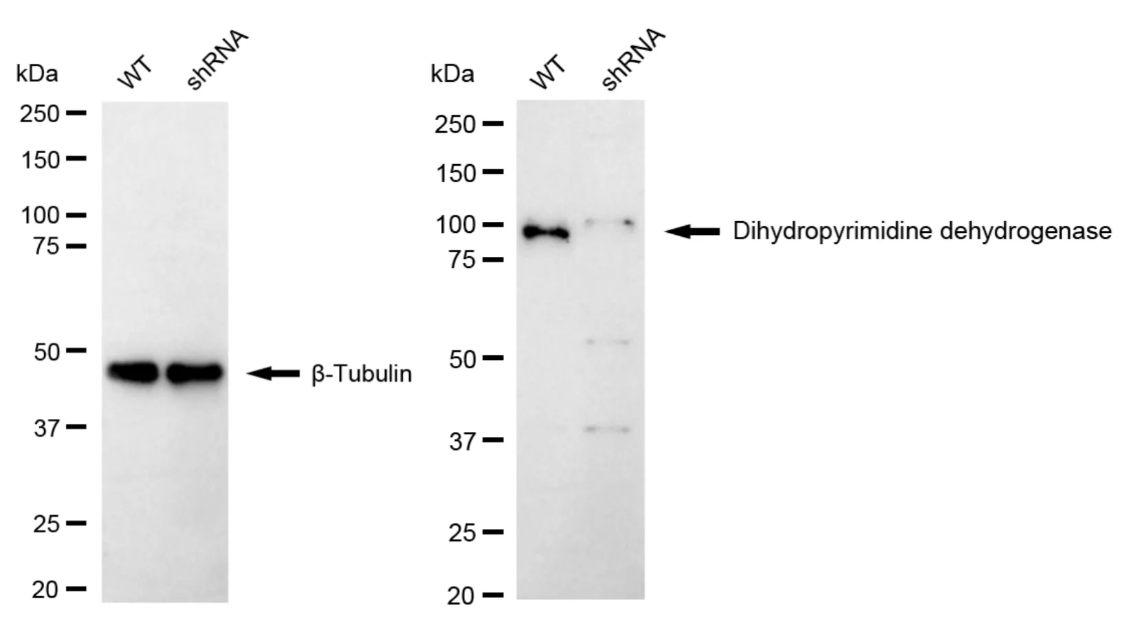 KD-Validated Dihydropyrimidine Dehydrogenase Recombinant Rabbit Monoclonal Antibody