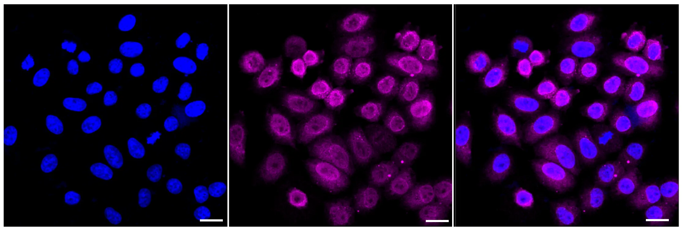 Immunocytochemistry(ICC) - KD-Validated Karyopherin Subunit Alpha 2 Recombinant Rabbit Monoclonal Antibody KVAb01799