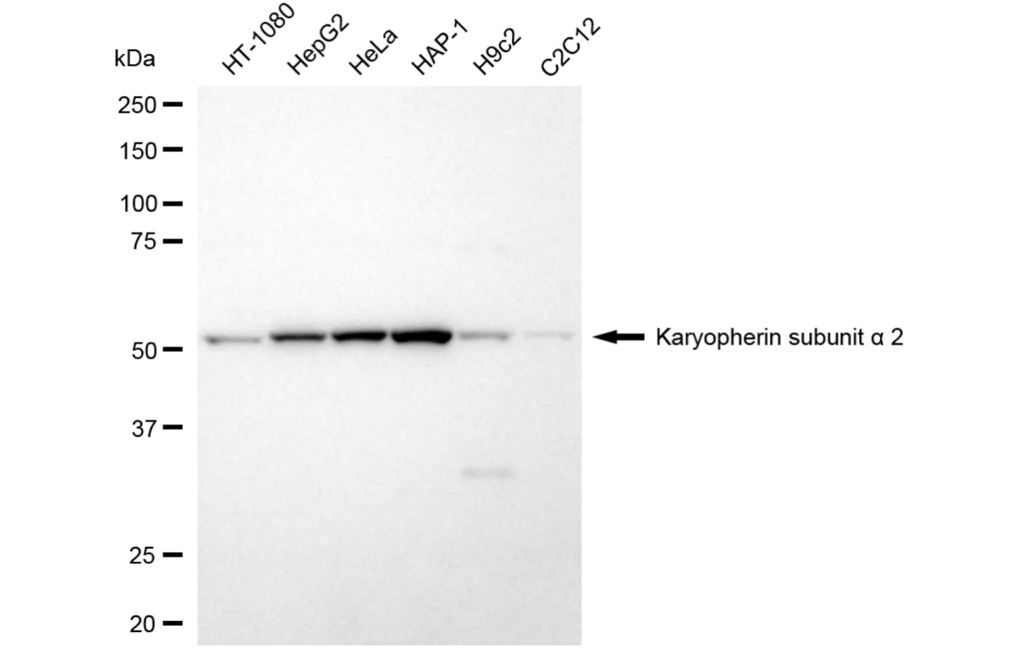 WesternBlot(WB) - KD-Validated Karyopherin Subunit Alpha 2 Recombinant Rabbit Monoclonal Antibody KVAb01799