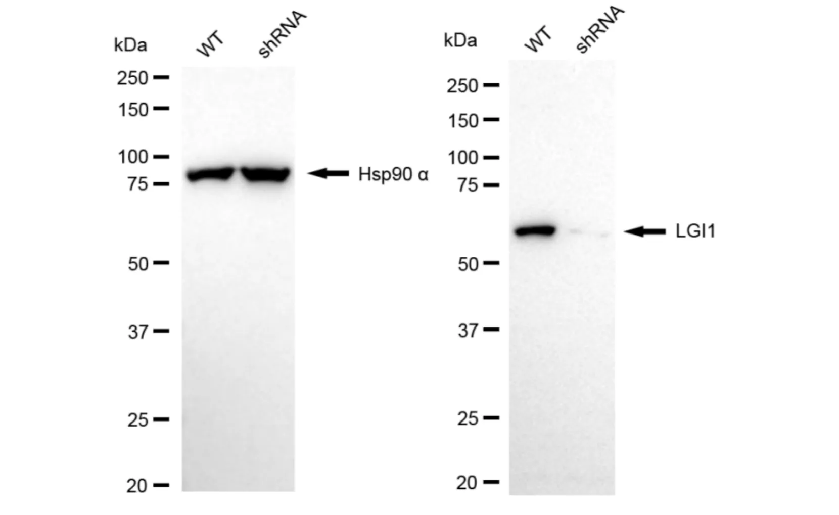 KD-Validated LGI1 Recombinant Rabbit Monoclonal Antibody