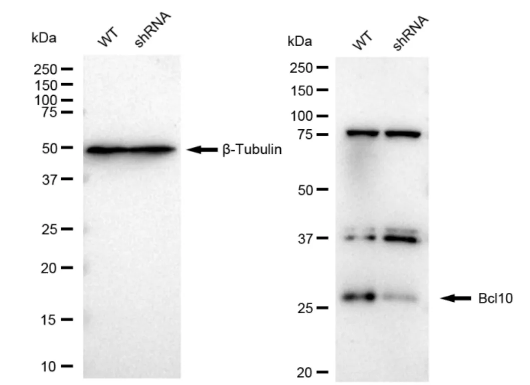 KD-Validated Bcl10 Recombinant Rabbit Monoclonal Antibody