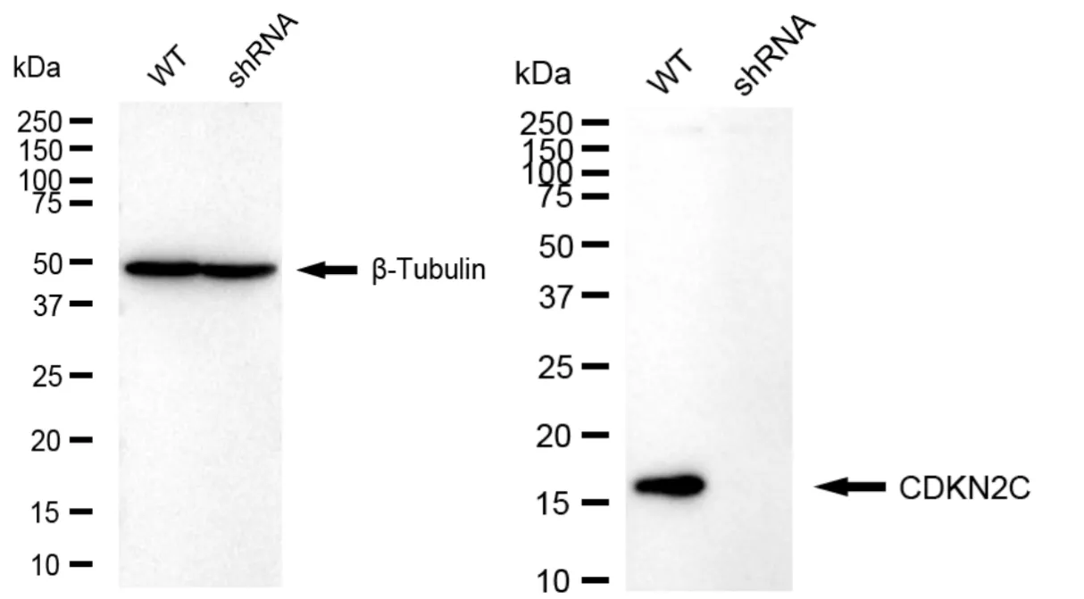 KD-Validated CDKN2C Recombinant Rabbit Monoclonal Antibody