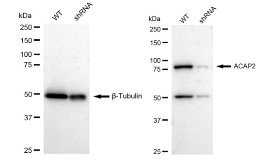 KD-Validated ACAP2 Recombinant Rabbit Monoclonal Antibody