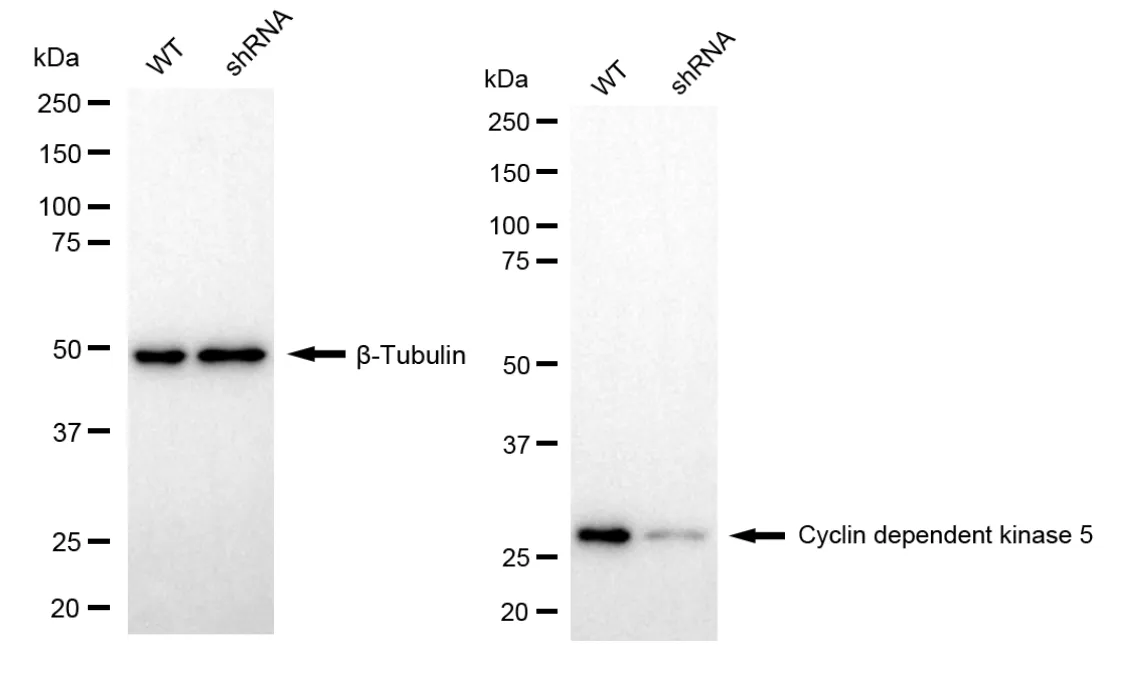 KD-Validated Cyclin Dependent Kinase 5 Recombinant Rabbit Monoclonal Antibody
