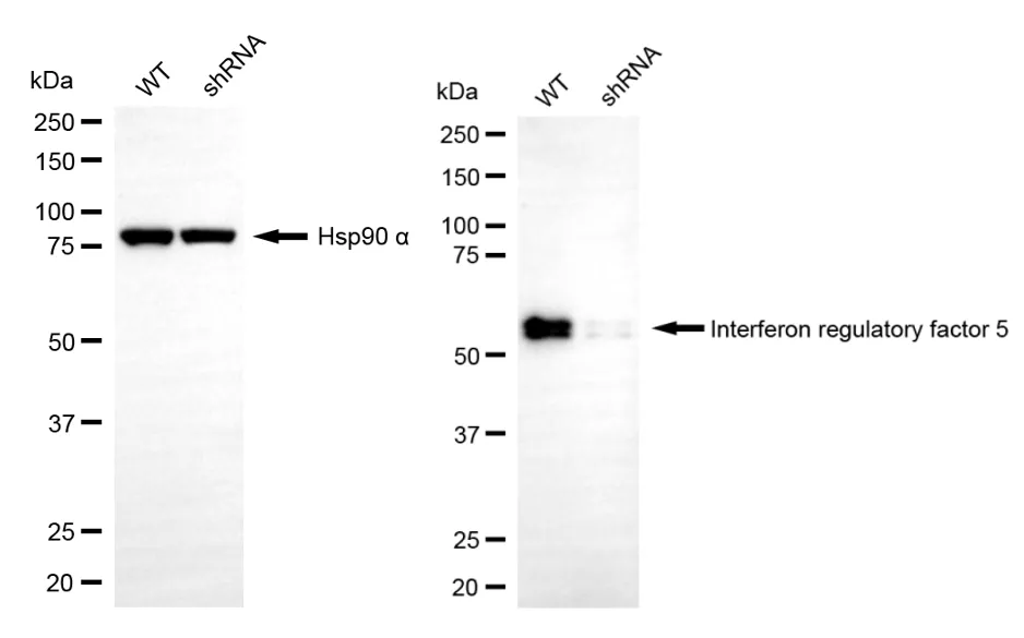 KD-Validated Interferon Regulatory Factor 5 Recombinant Rabbit Monoclonal Antibody