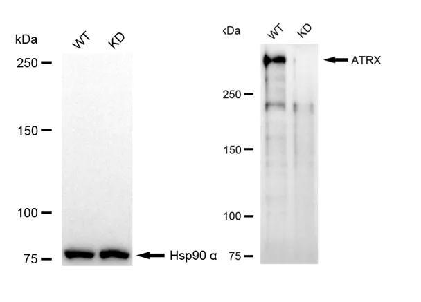 KD-Validated ATRX Mouse Monoclonal Antibody