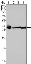 Nucleophosmin Mouse Monoclonal Antibody - Size: 50µl