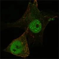 Foxp3 Mouse Monoclonal Antibody - Size: 100µl
